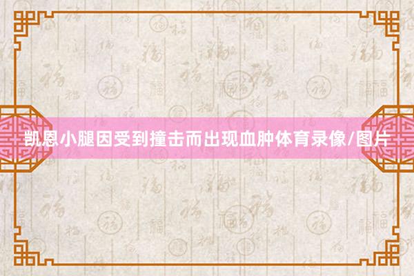凯恩小腿因受到撞击而出现血肿体育录像/图片